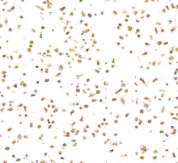 Rabbit anti-CD30 Recombinant Monoclonal Antibody