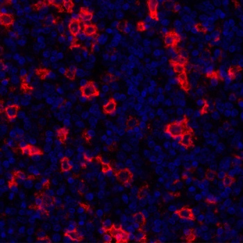 Rabbit anti-CD30 Recombinant Monoclonal Antibody
