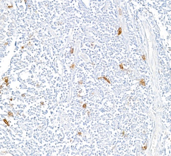 Rabbit anti-CD30 Recombinant Monoclonal Antibody