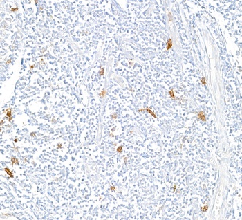 CD30 Antibody