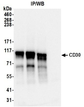 Rabbit anti-CD30 Recombinant Monoclonal Antibody