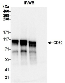 CD30 Antibody