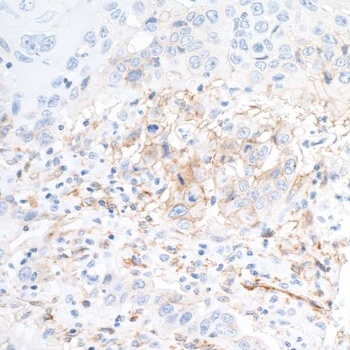 CD73 Antibody