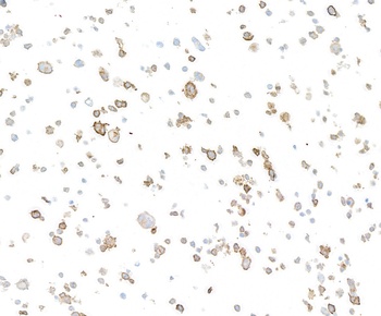 Rabbit anti-CD137 Recombinant Monoclonal Antibody