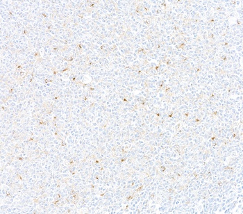 Rabbit anti-CD137 Recombinant Monoclonal Antibody