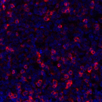 Rabbit anti-TIGIT Recombinant Monoclonal Antibody