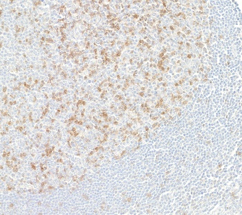 Rabbit anti-TIGIT Recombinant Monoclonal Antibody