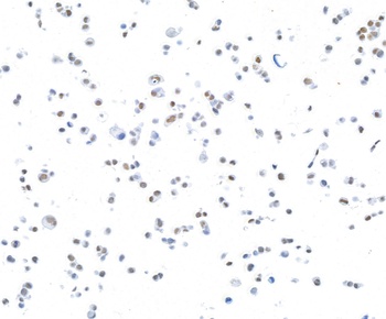 Rabbit anti-CTCF Recombinant Monoclonal Antibody