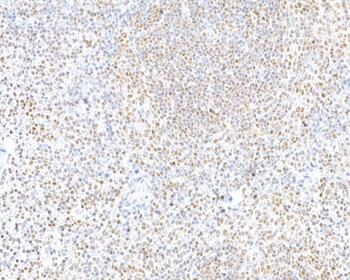 Rabbit anti-CTCF Recombinant Monoclonal Antibody