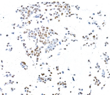 Rabbit anti-CTCF Recombinant Monoclonal Antibody