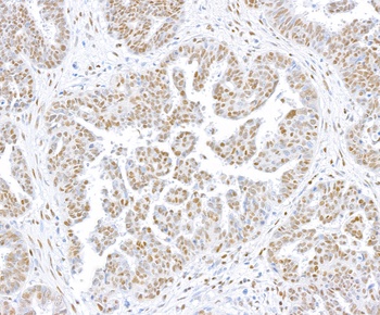 Rabbit anti-CTCF Recombinant Monoclonal Antibody