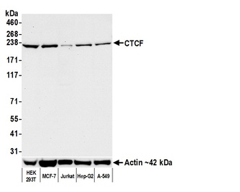 Rabbit anti-CTCF Recombinant Monoclonal Antibody