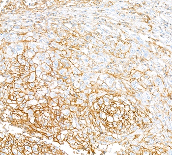 Rabbit anti-CD44 Recombinant Monoclonal Antibody
