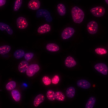 Rabbit anti-Ki-67 Recombinant Monoclonal Antibody