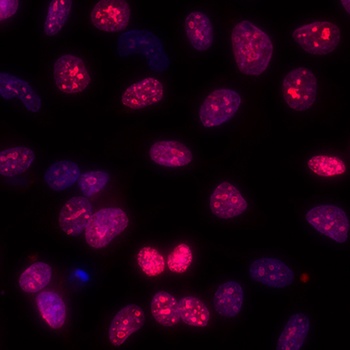 Ki-67 Antibody