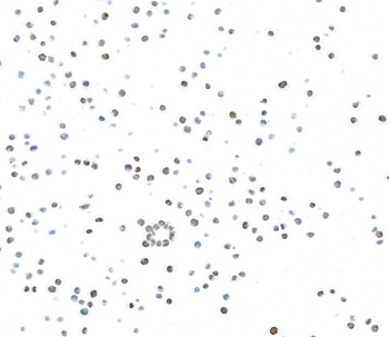 Rabbit anti-Ki-67 Recombinant Monoclonal Antibody