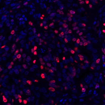 Rabbit anti-Ki-67 Recombinant Monoclonal Antibody