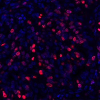 Ki-67 Antibody