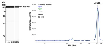 Rabbit anti-PBRM1 Recombinant Monoclonal Antibody