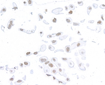 Rabbit anti-SMC1 Recombinant Monoclonal Antibody