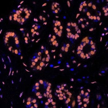 Rabbit anti-SMC1 Recombinant Monoclonal Antibody