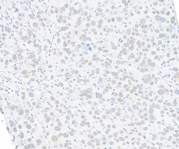 Rabbit anti-SMC1 Recombinant Monoclonal Antibody