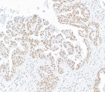 Rabbit anti-SMC1 Recombinant Monoclonal Antibody