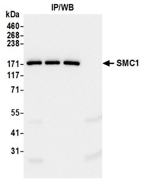 Rabbit anti-SMC1 Recombinant Monoclonal Antibody