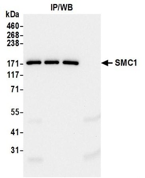 SMC1 Antibody