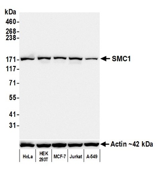 Rabbit anti-SMC1 Recombinant Monoclonal Antibody