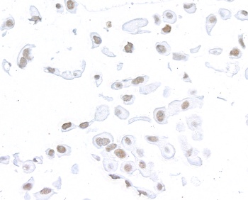 SMC1 Antibody