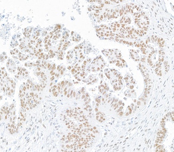 SMC1 Antibody