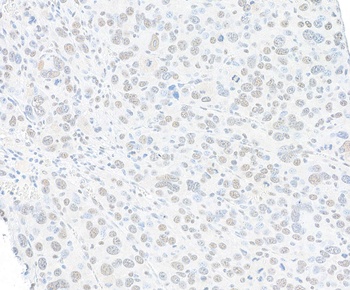 SMC1 Antibody