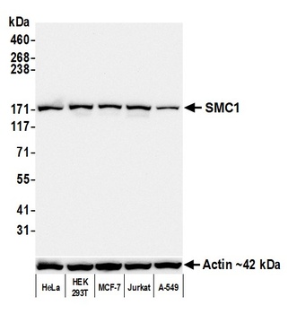 SMC1 Antibody