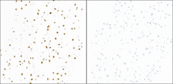 Rabbit anti-Phospho KAP-1 (S824) Recombinant Monoclonal Antibody