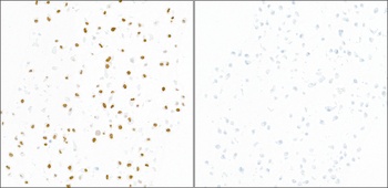 KAP-1, Phospho (S824) Antibody