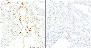 Rabbit anti-Phospho KAP-1 (S824) Recombinant Monoclonal Antibody