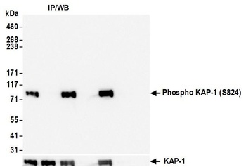 KAP-1, Phospho (S824) Antibody
