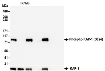 Rabbit anti-Phospho KAP-1 (S824) Recombinant Monoclonal Antibody