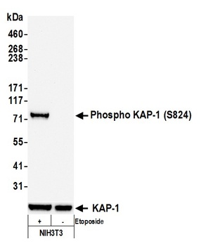 Rabbit anti-Phospho KAP-1 (S824) Recombinant Monoclonal Antibody