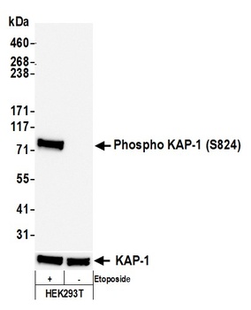 Rabbit anti-Phospho KAP-1 (S824) Recombinant Monoclonal Antibody