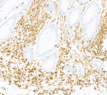 Rabbit anti-CD45 Recombinant Monoclonal Antibody