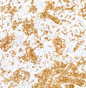 Rabbit anti-CD45 Recombinant Monoclonal Antibody