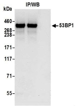 Rabbit anti-53BP1 Recombinant Monoclonal Antibody