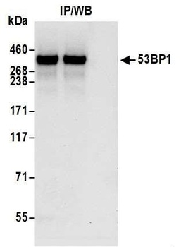 53BP1 Antibody