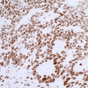 Rabbit anti-53BP1 Recombinant Monoclonal Antibody