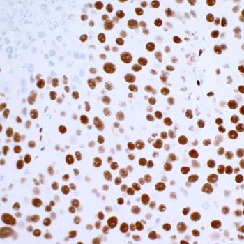 53BP1 Antibody