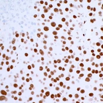 Rabbit anti-53BP1 Recombinant Monoclonal Antibody