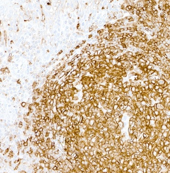 Mouse anti-HLA-DR Monoclonal Antibody