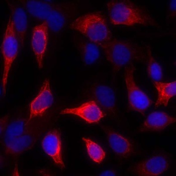 Cytokeratin Antibody